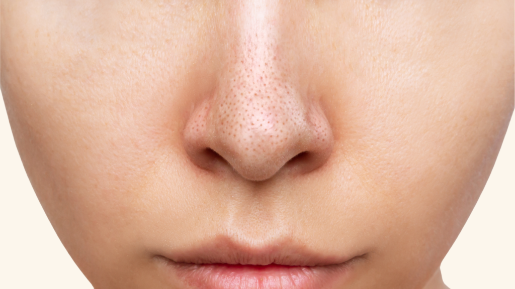 Historia de Instagram Estética Limpieza Facial Skincare Moderno Violeta (Sitio web) (1)